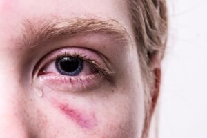 婚活のトラウマを克服するために試すべき方法は？
